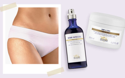 Stretch Mark Treatments That Actually Work, According To A Derma