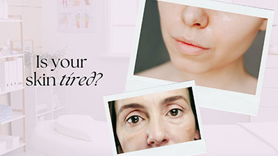 “Your Skin Is Tired”—How to Know If You Need a Professional Reset